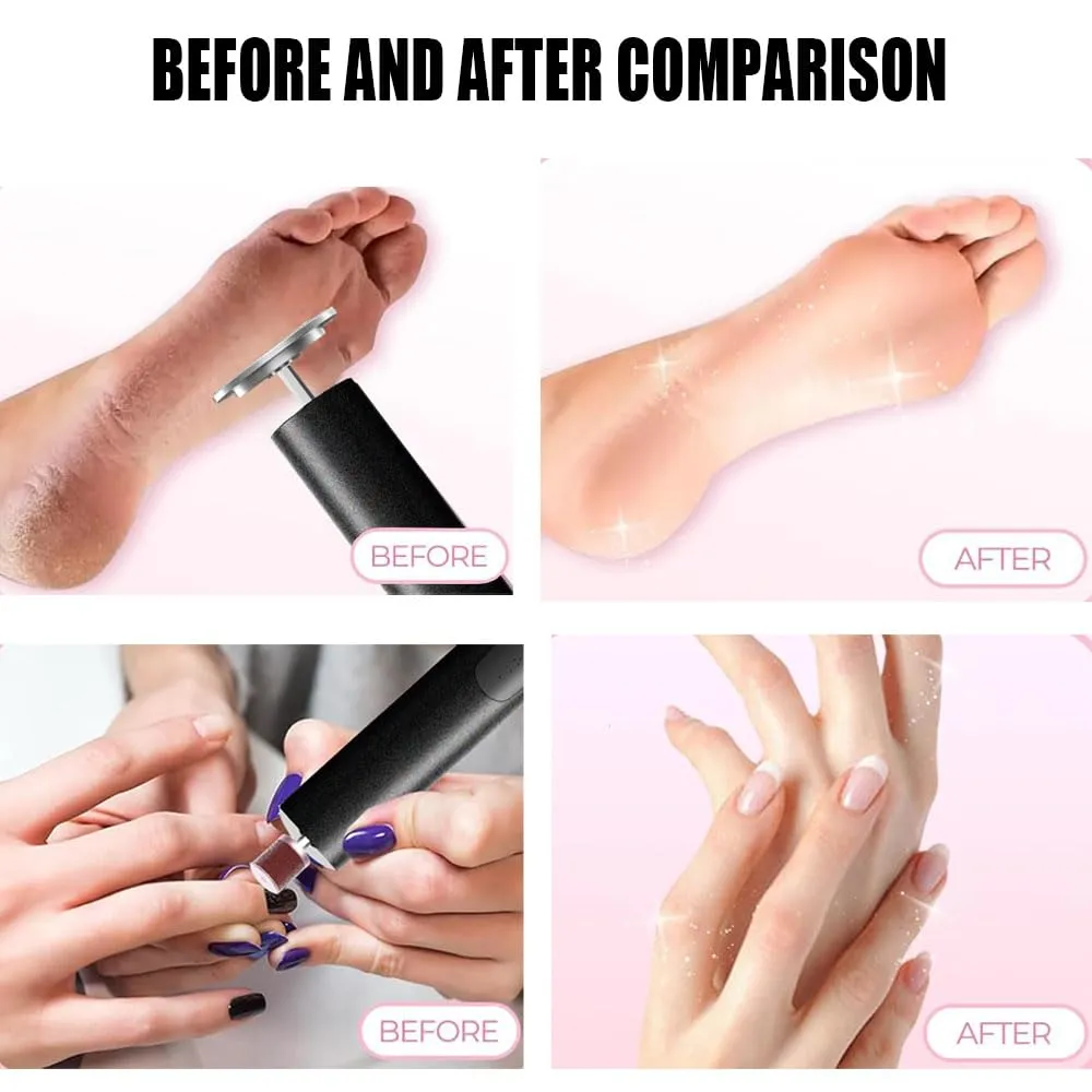 Cordless Electric Callus Remover for Feet with Nail File Sander 2 in 1 Rechargeable Foot File Grinder for Dead Skin Crack Dry Calluses with Sandpaper Disk 6 Speed Adjustable