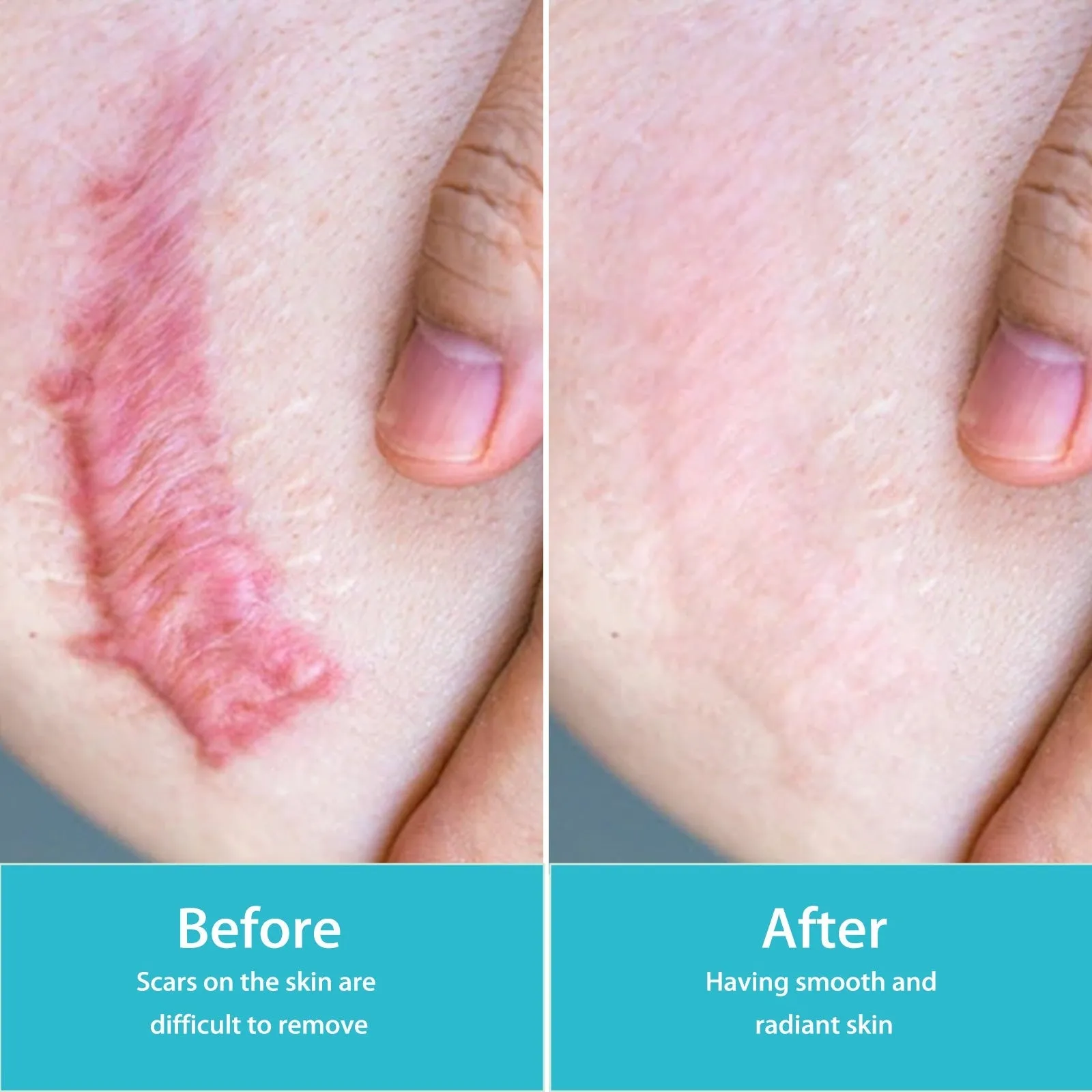 Scar Lightening Body Spray