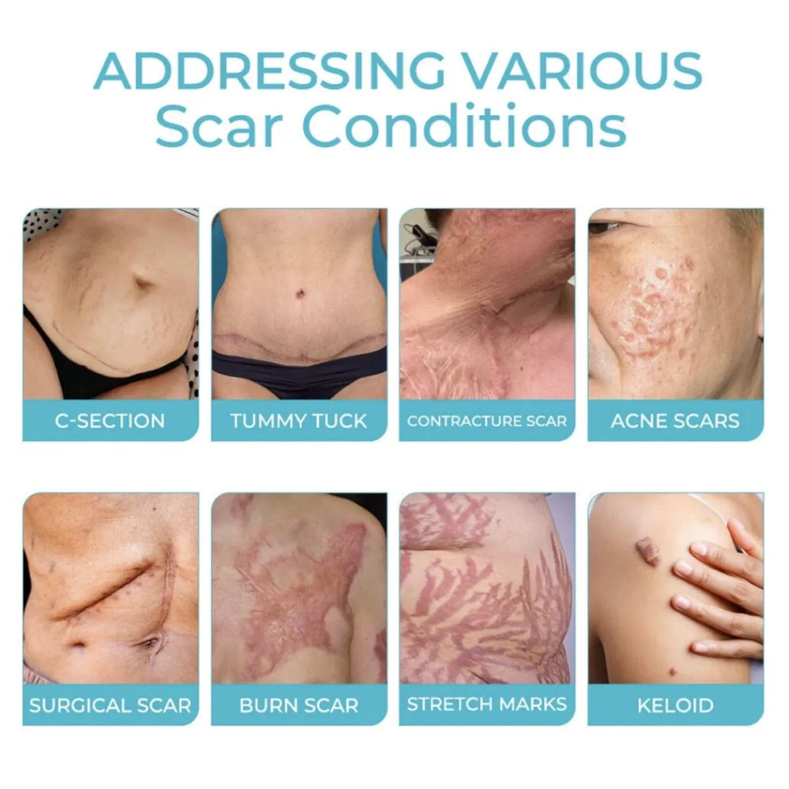 Scar Lightening Body Spray